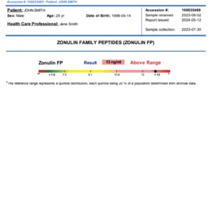 Histamine et Diamine oxydase