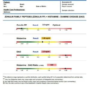 Zonuline, Histamine et Diamine Oxydase